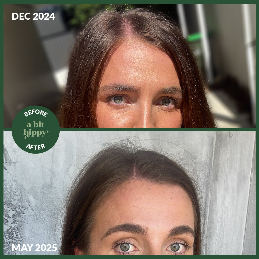 Before and after photos of the effects of A bit Hippy Hair Growth & Volume product, showing fuller and healthier hair. 
