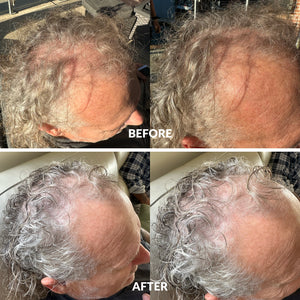 Hair Growth Serum 50ml