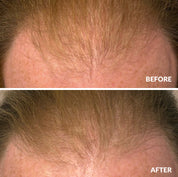 Hair Growth Serum 50ml