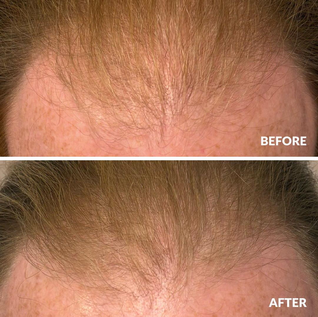 Hair Growth Serum 50ml