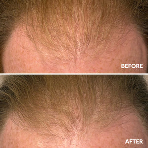 Hair Growth Serum 50ml