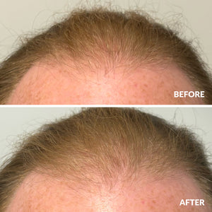 Hair Growth Serum 50ml