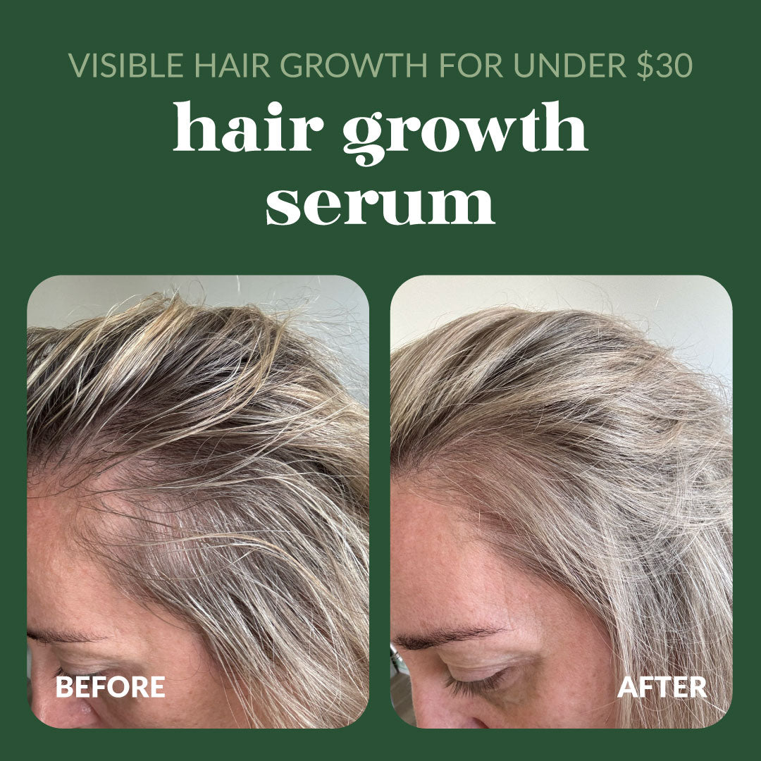 AbH-HairGrowth-MegaMenu-2.jpg
